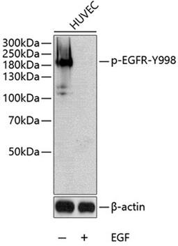 Western blot - Phospho-EGFR-Y998 antibody (AP0024)