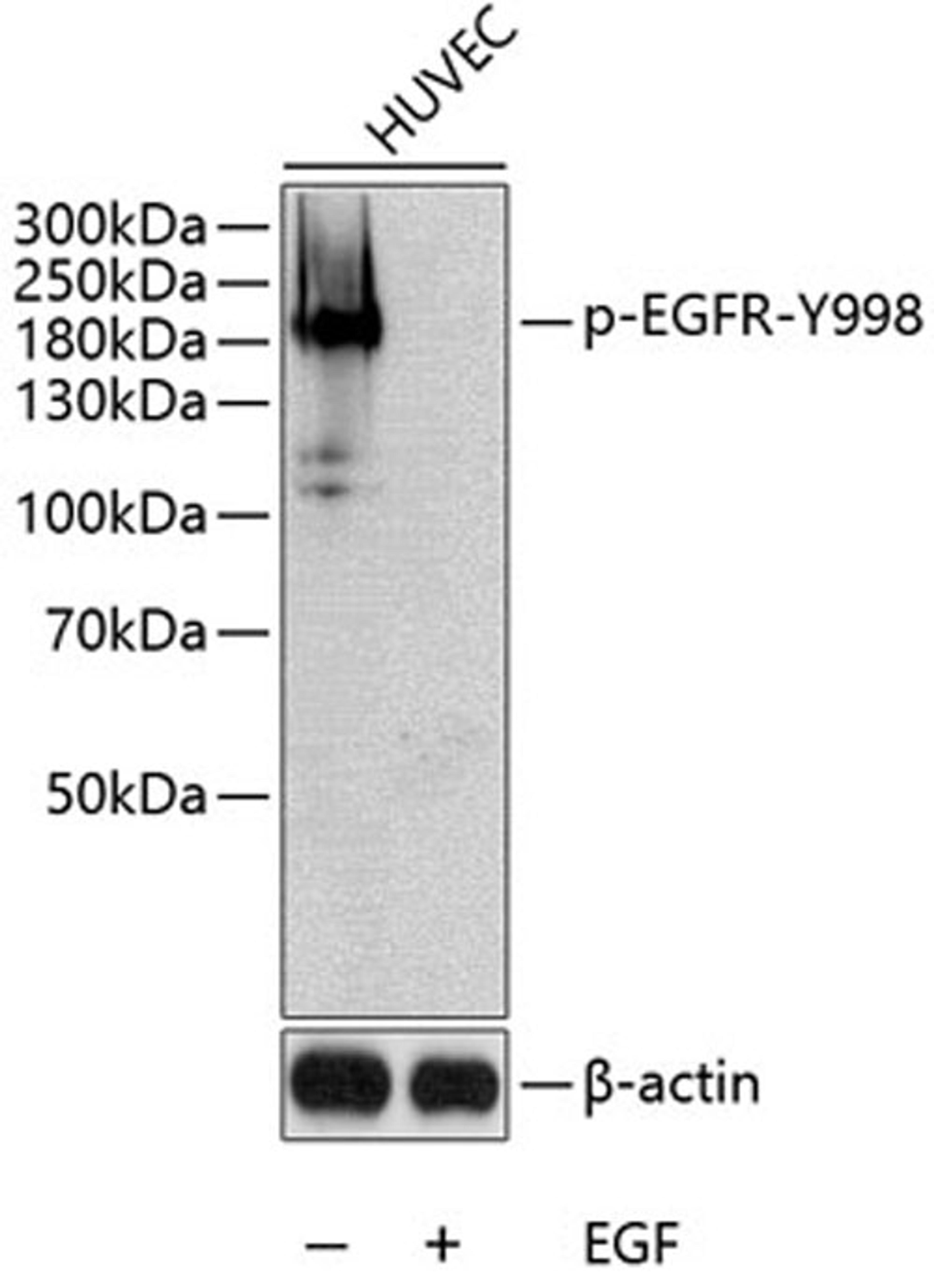 Western blot - Phospho-EGFR-Y998 antibody (AP0024)