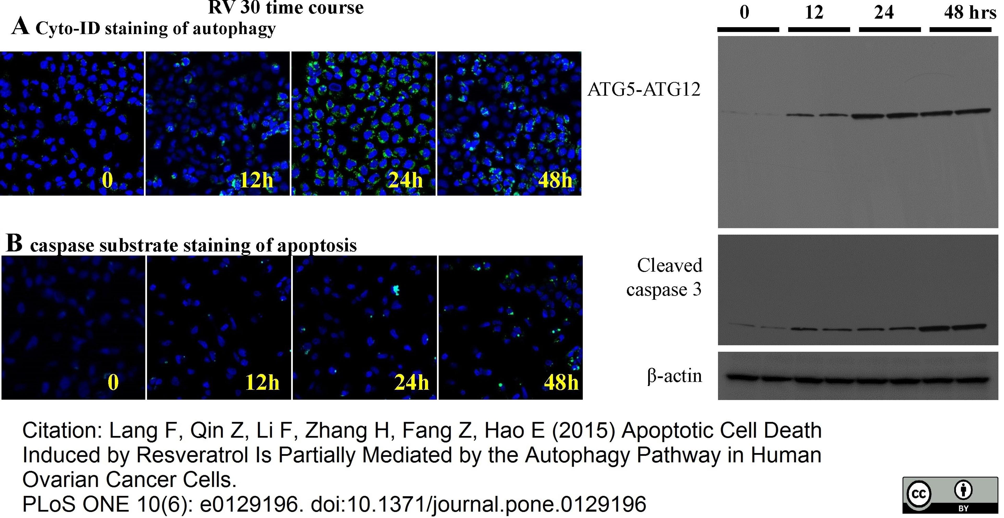 Rabbit anti ATG5-ATG12 Complex antibody used for the evaluation of ATG5-ATG12 conjugate expression