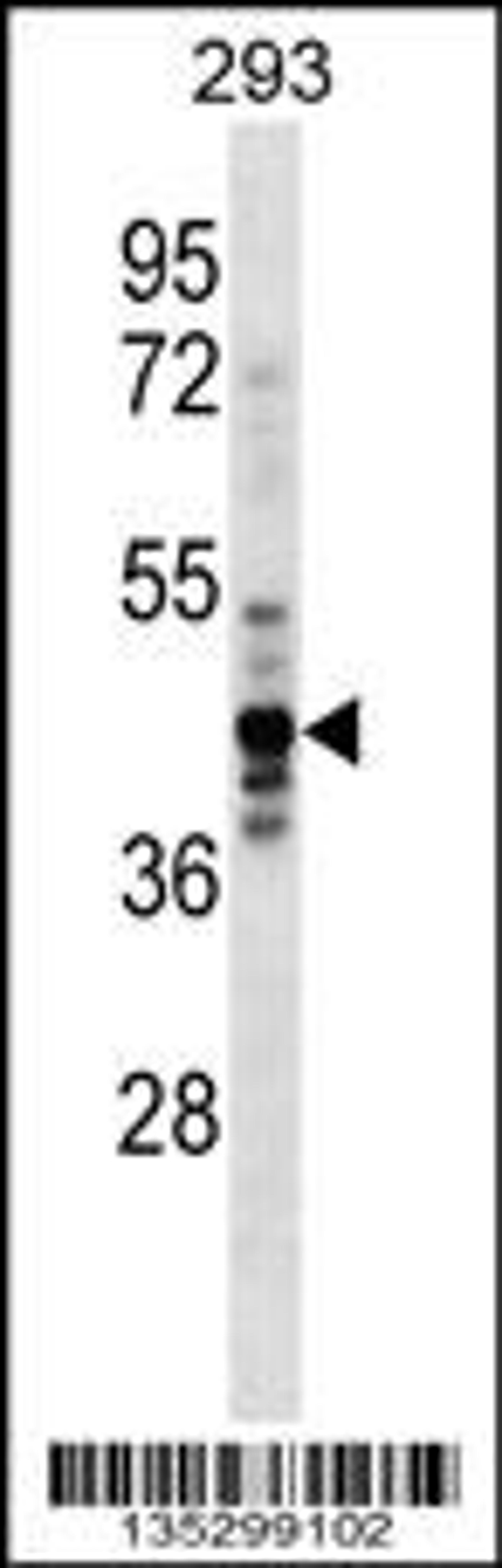 Western blot analysis in 293 cell line lysates (35ug/lane).