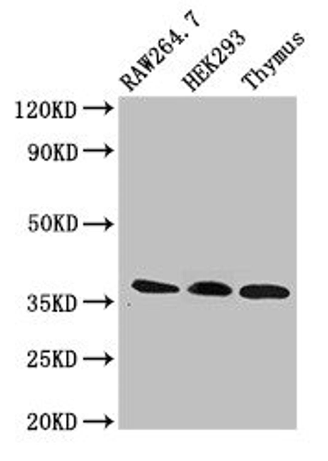 Western Blot. Positive WB detected in: RAW264.7 whole cell lysate, HEK293 whole cell lysate, Rat thymus tissue. All lanes: FHL1 antibody at 3µg/ml. Secondary. Goat polyclonal to rabbit IgG at 1/50000 dilution. Predicted band size: 37, 32, 23, 35, 34 kDa. Observed band size: 37 kDa