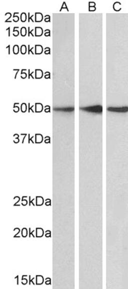 46-212 (0.1ug/ml) staining of Human Cerebellum (A), Mouse (B) and Rat (C) Brain lysate (35ug protein in RIPA buffer). Primary incubation was 1 hour. Detected by chemiluminescence.