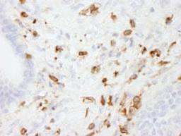 Detection of human Coronin 1 by immunohistochemistry.