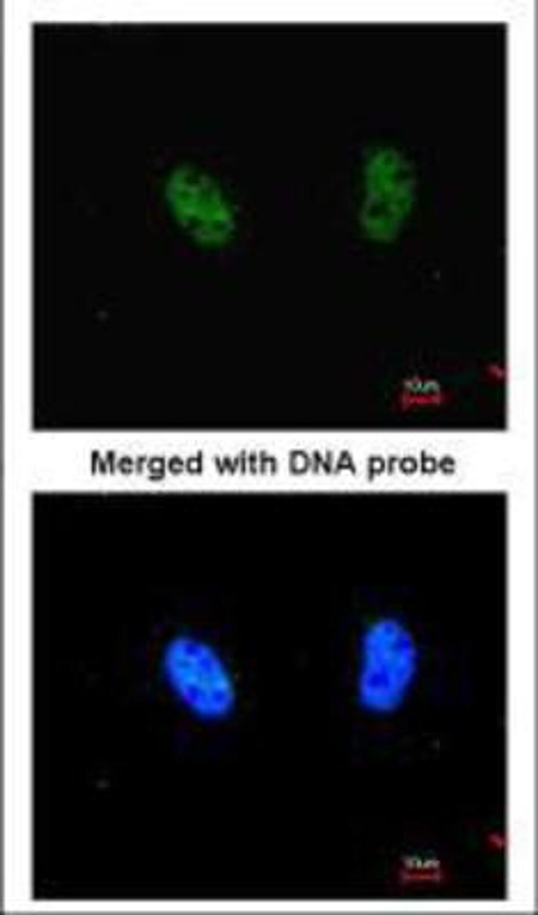 Immunocytochemistry/Immunofluorescence: RAD50 Antibody (13B3) [NB100-147] - ICC of Hela cells