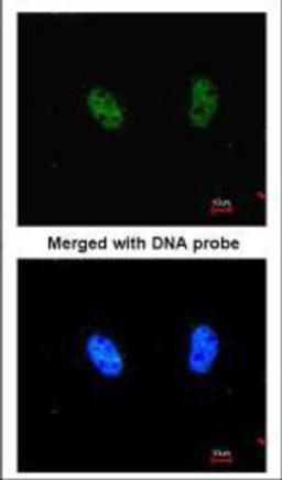 Immunocytochemistry/Immunofluorescence: RAD50 Antibody (13B3) [NB100-147] - ICC of Hela cells