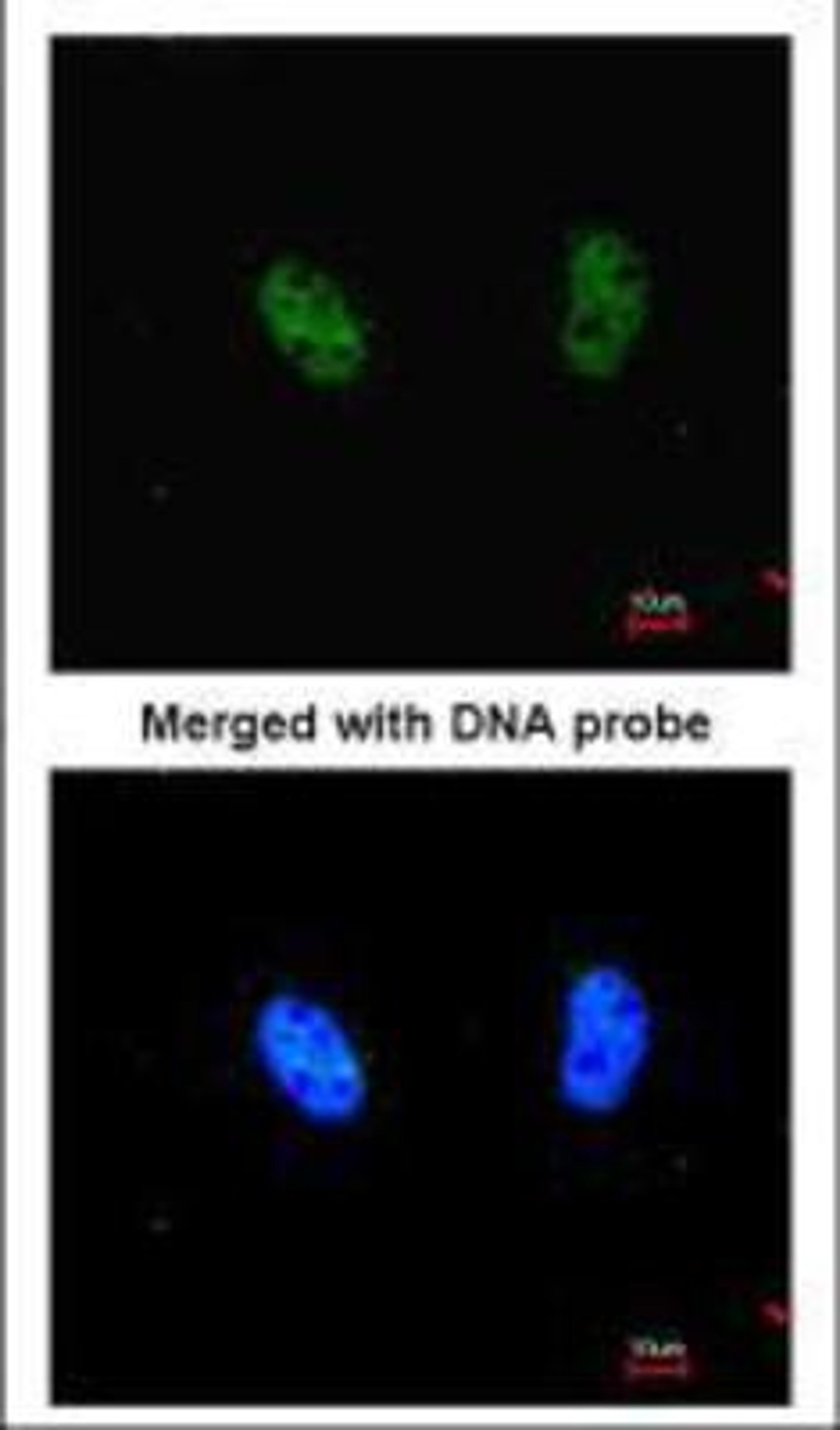 Immunocytochemistry/Immunofluorescence: RAD50 Antibody (13B3) [NB100-147] - ICC of Hela cells