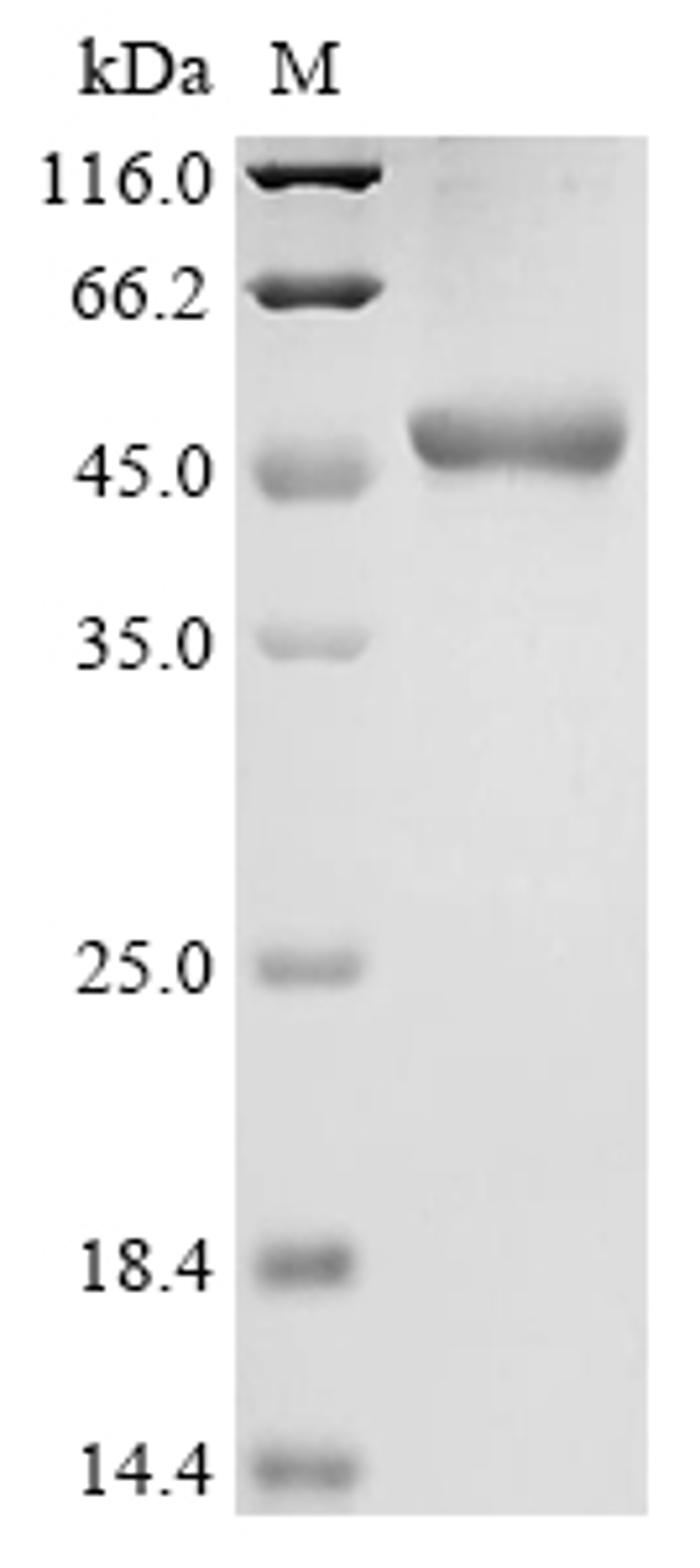 (Tris-Glycine gel) Discontinuous SDS-PAGE (reduced) with 5% enrichment gel and 15% separation gel.