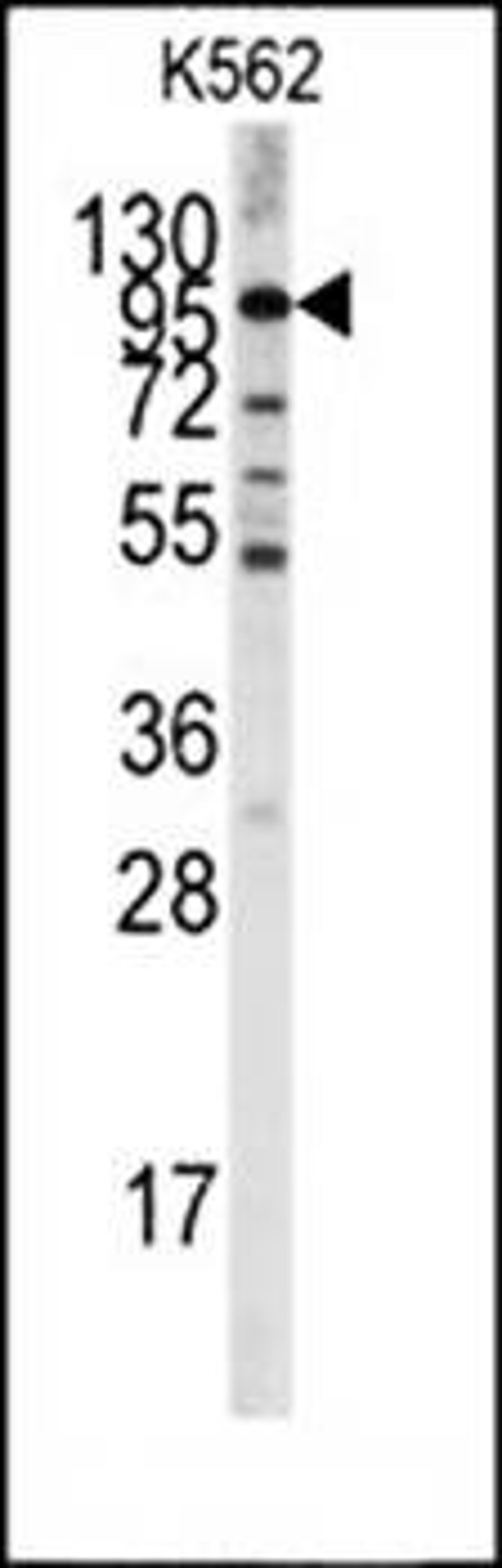 Western blot analysis of K562 cell line lysates (35ug/lane) using LGR5 antibody