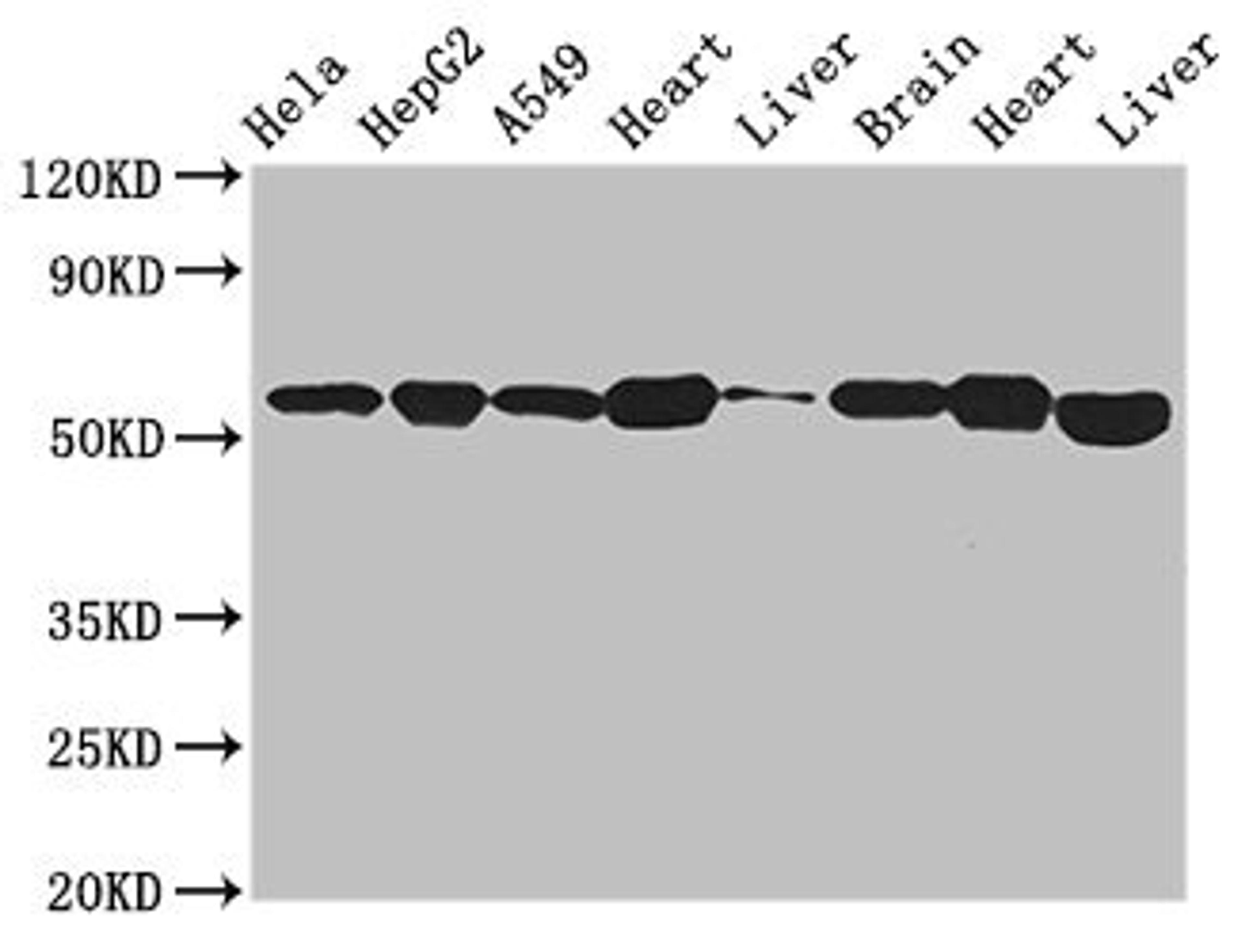 Western Blot. Positive WB detected in: Hela whole cell lysate, HepG2 whole cell lysate, A549 whole cell lysate, Mouse heart tissue, Mouse liver tissue, Mouse brain tissue, Rat heart tissue, Rat liver tissue. All lanes: ATP5B antibody at 2.7µg/ml. Secondary. Goat polyclonal to rabbit IgG at 1/50000 dilution. Predicted band size: 57 kDa. Observed band size: 57 kDa