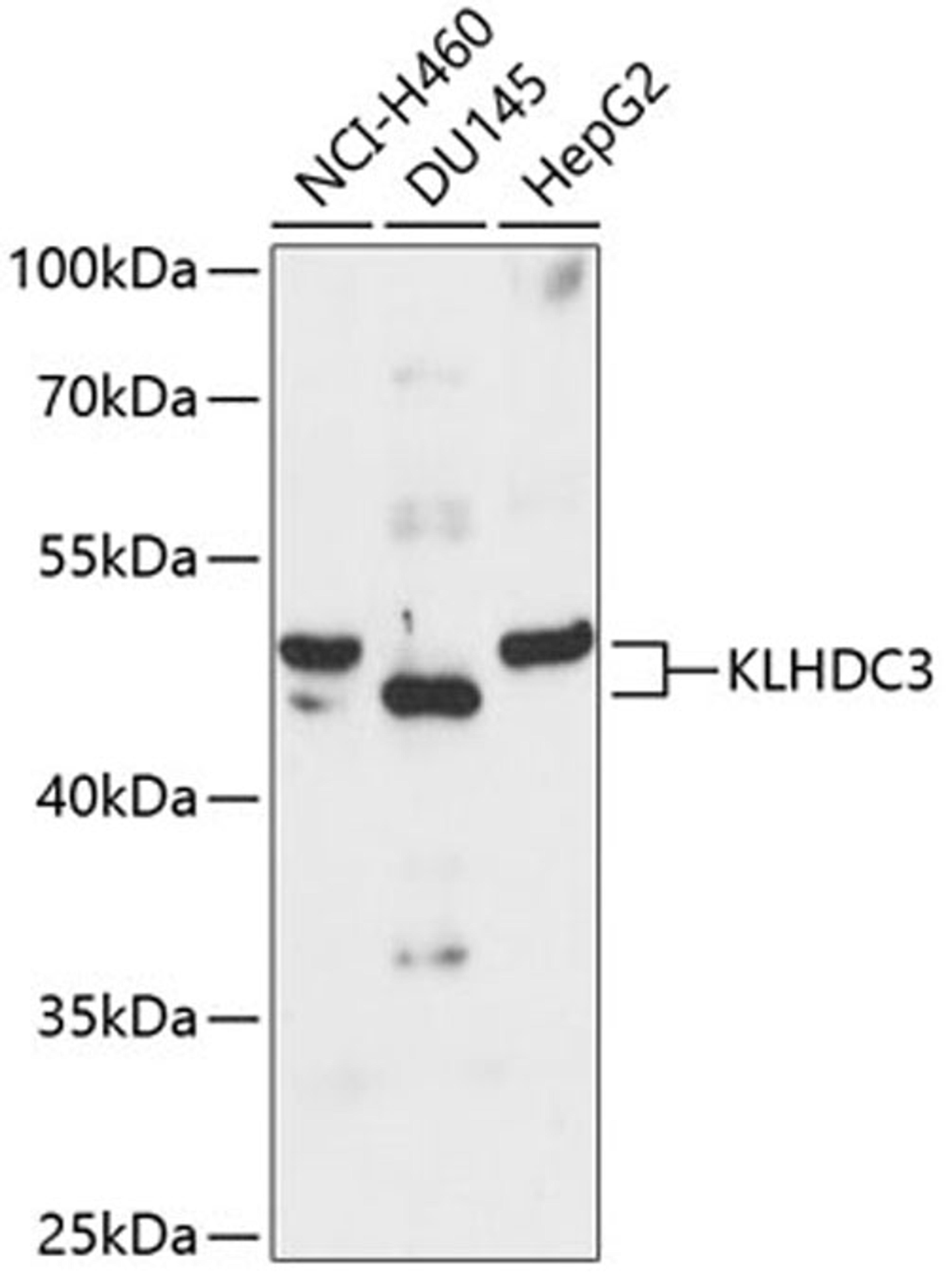 Western blot - KLHDC3 antibody (A13741)