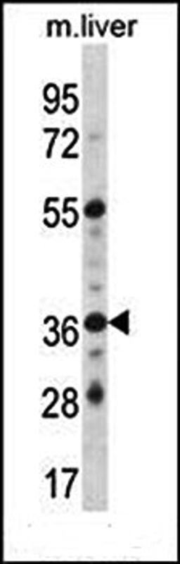 Western blot analysis of mouse liver tissue lysates (35ug/lane) using GPER (C-term) antibody