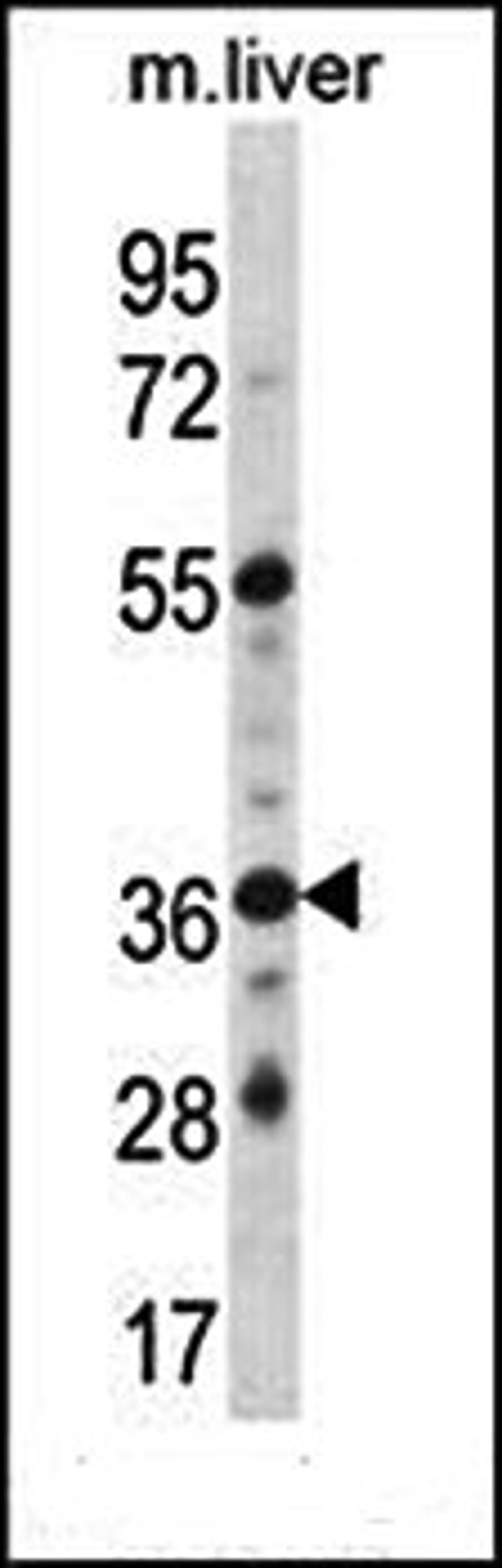 Western blot analysis of mouse liver tissue lysates (35ug/lane) using GPER (C-term) antibody