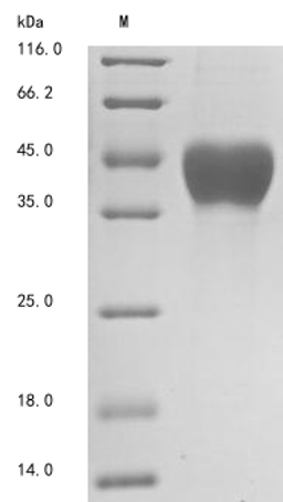 (Tris-Glycine gel) Discontinuous SDS-PAGE (reduced) with 5% enrichment gel and 15% separation gel.