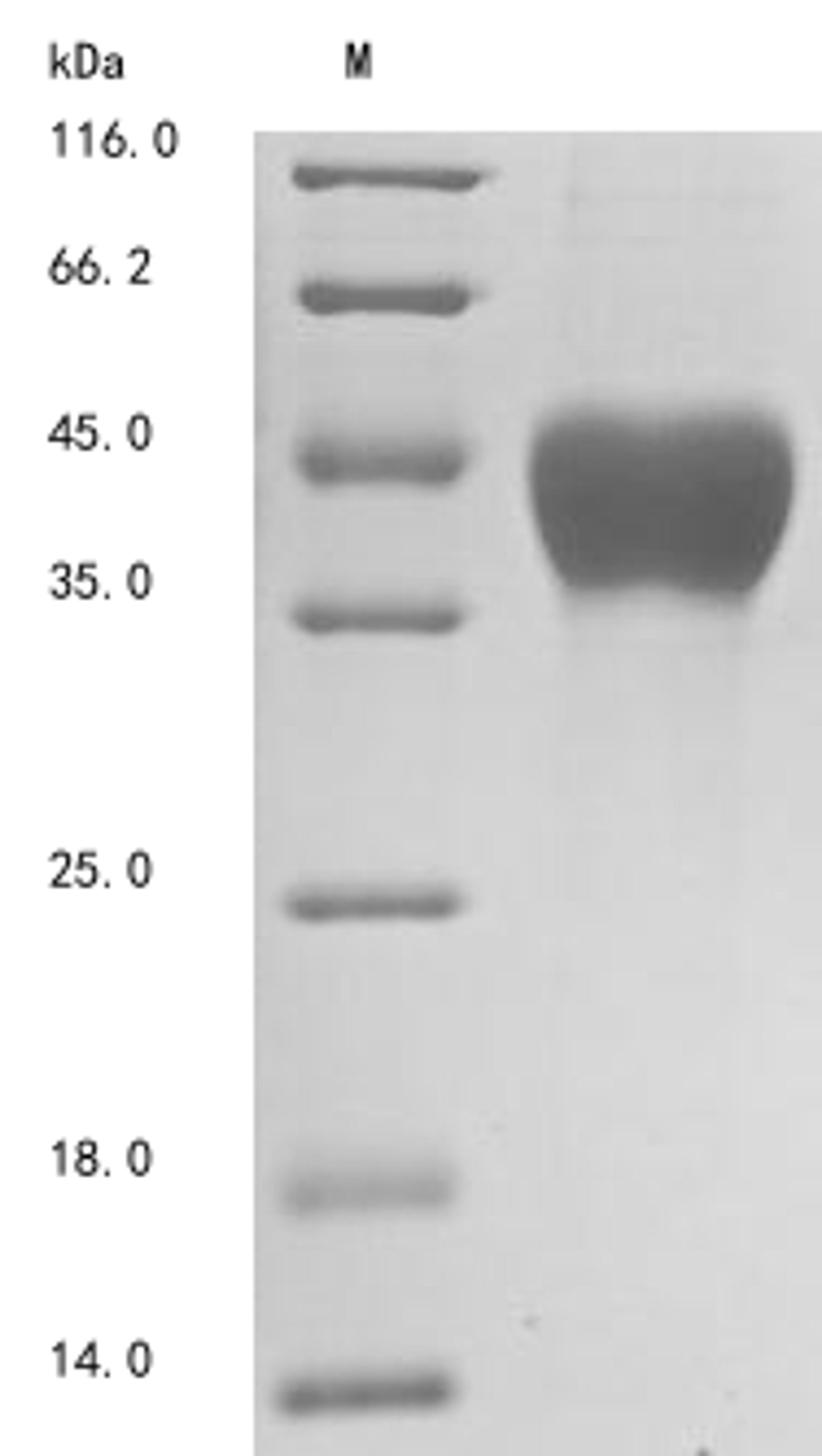 (Tris-Glycine gel) Discontinuous SDS-PAGE (reduced) with 5% enrichment gel and 15% separation gel.