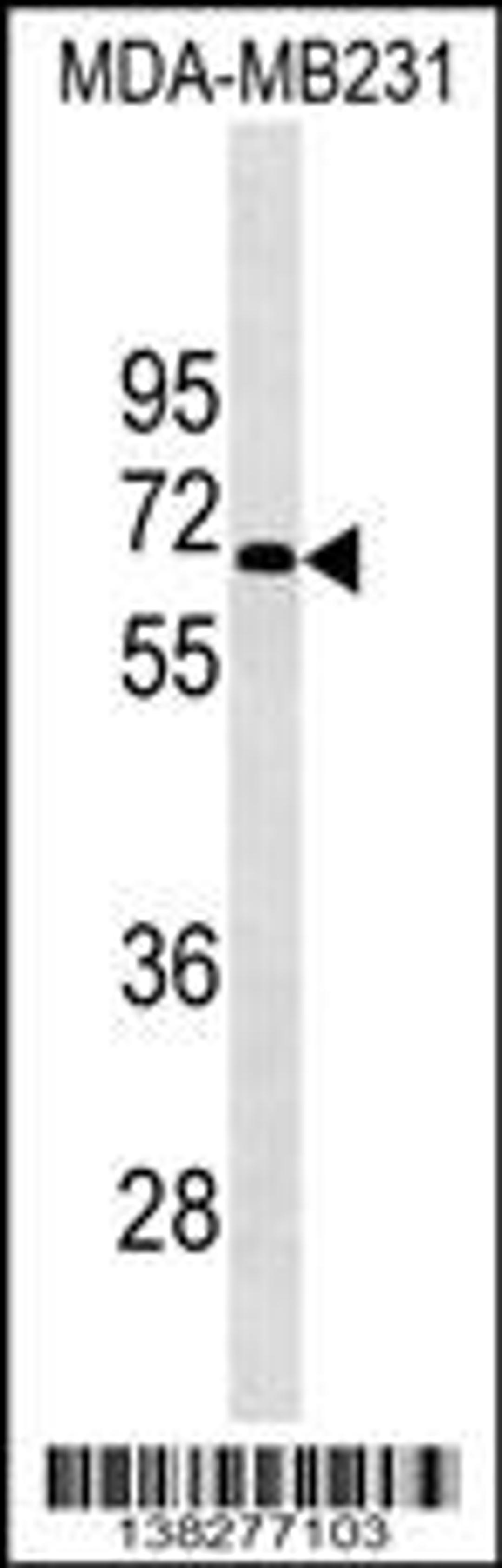 Western blot analysis in MDA-MB231 cell line lysates (35ug/lane).