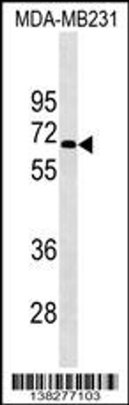 Western blot analysis in MDA-MB231 cell line lysates (35ug/lane).