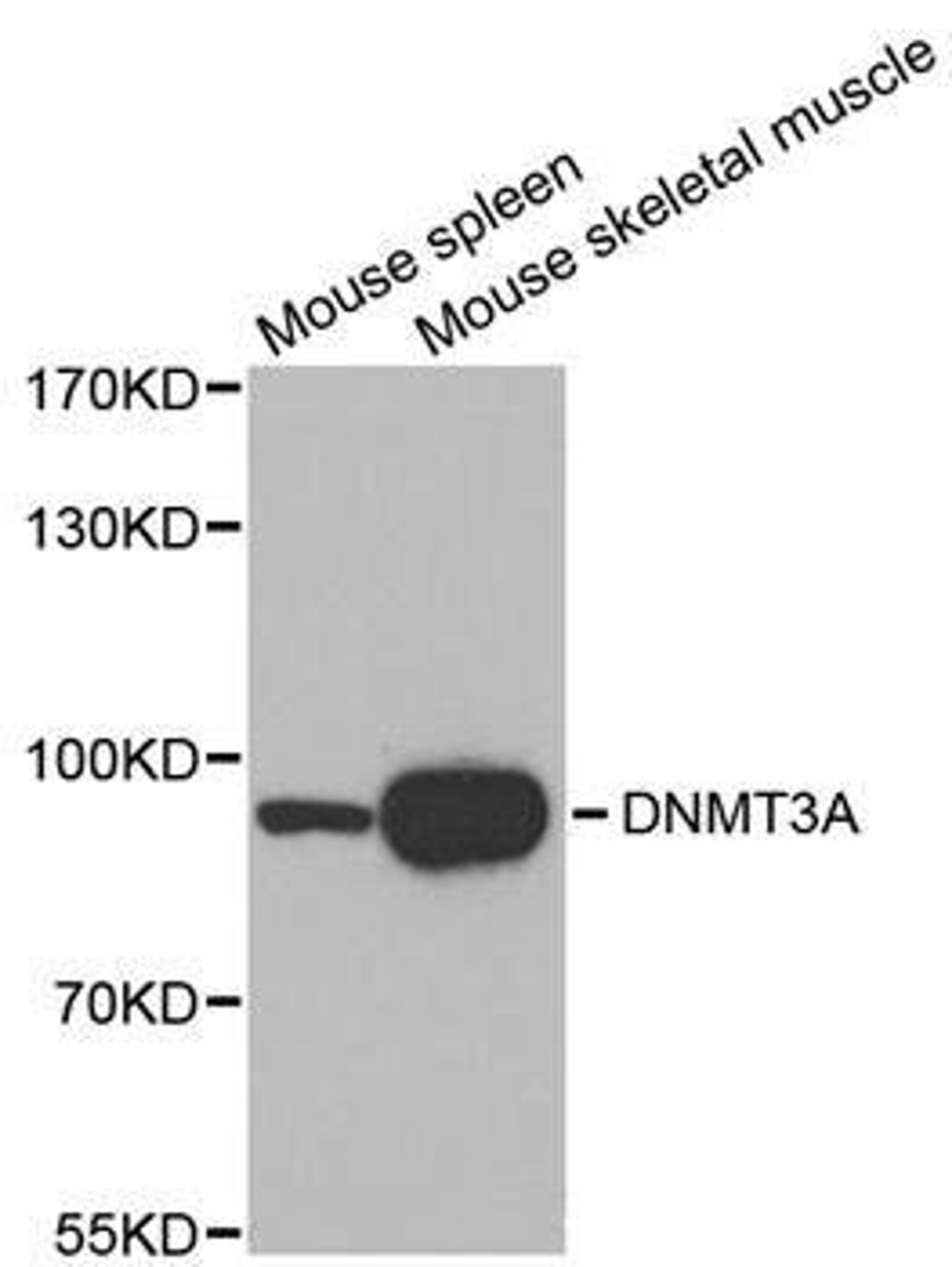 Western blot analysis of extracts of various tissues using DNMT3A antibody