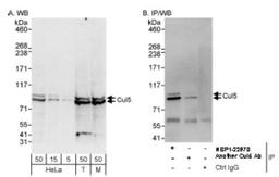 Western Blot: Cullin 5 Antibody [NBP1-22970] - by Western Blot (h&m) and Immunoprecipitation (h). Samples: Whole cell lysate from HeLa (5, 15 and 50 mcg for WB; 1 mg for IP, 20% of IP loaded), 293T (T; 50 mcg) and mouse NIH3T3 (M; 50mcg) cells. Antibodies: Affinity purified rabbit anti-Cul5 antibody used for WB at 0.1 mcg/ml (A) and 1 mcg/ml (B) and used for IP at 10 mcg/mg lysate. Cul5 was also immunoprecipitated by another rabbit anti-Cul5 antibody, which recognizes a downstream epitope.