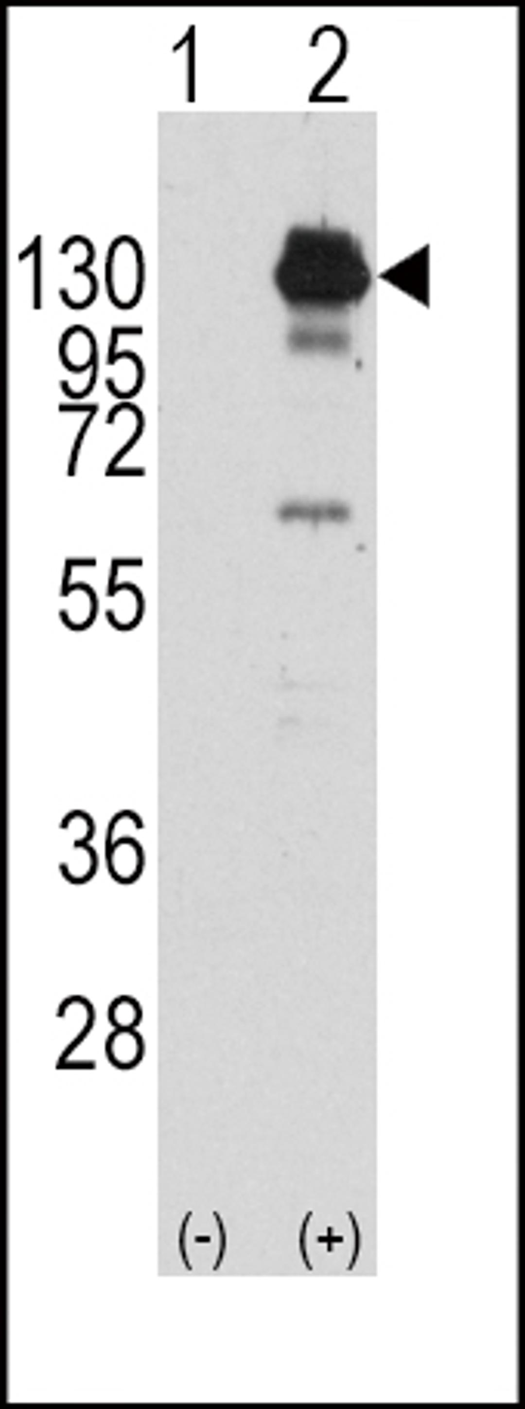 Western blot analysis of PDGFRA using rabbit polyclonal PDGFRA Antibody (Y762) using 293 cell lysates (2 ug/lane) either nontransfected (Lane 1) or transiently transfected with the PDGFRA gene (Lane 2).