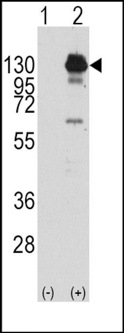 Western blot analysis of PDGFRA using rabbit polyclonal PDGFRA Antibody (Y762) using 293 cell lysates (2 ug/lane) either nontransfected (Lane 1) or transiently transfected with the PDGFRA gene (Lane 2).