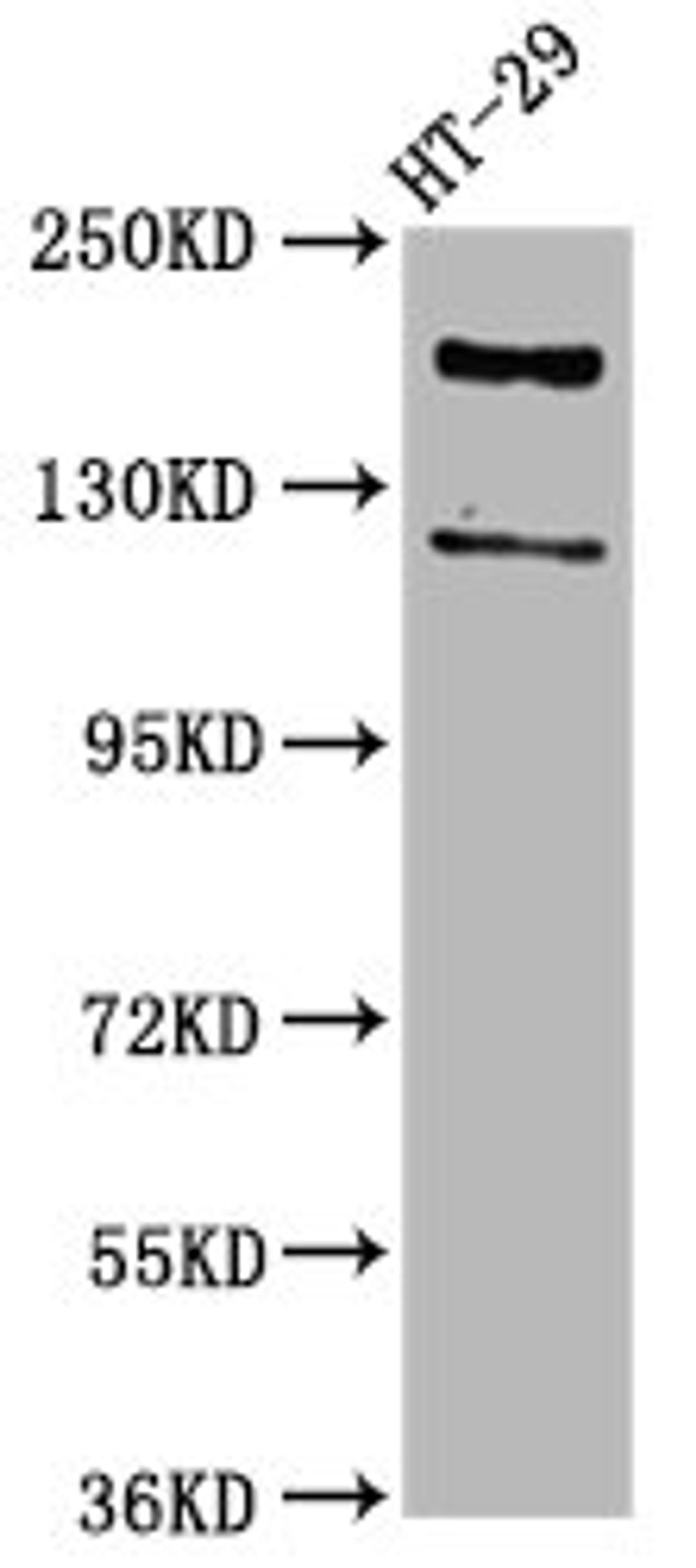 Western Blot. Positive WB detected in: HT29 whole cell lysate. All lanes: SYNJ1 antibody at 3.7µg/ml. Secondary. Goat polyclonal to rabbit IgG at 1/50000 dilution. Predicted band size: 174, 145, 144, 59 kDa. Observed band size: 174 kDa