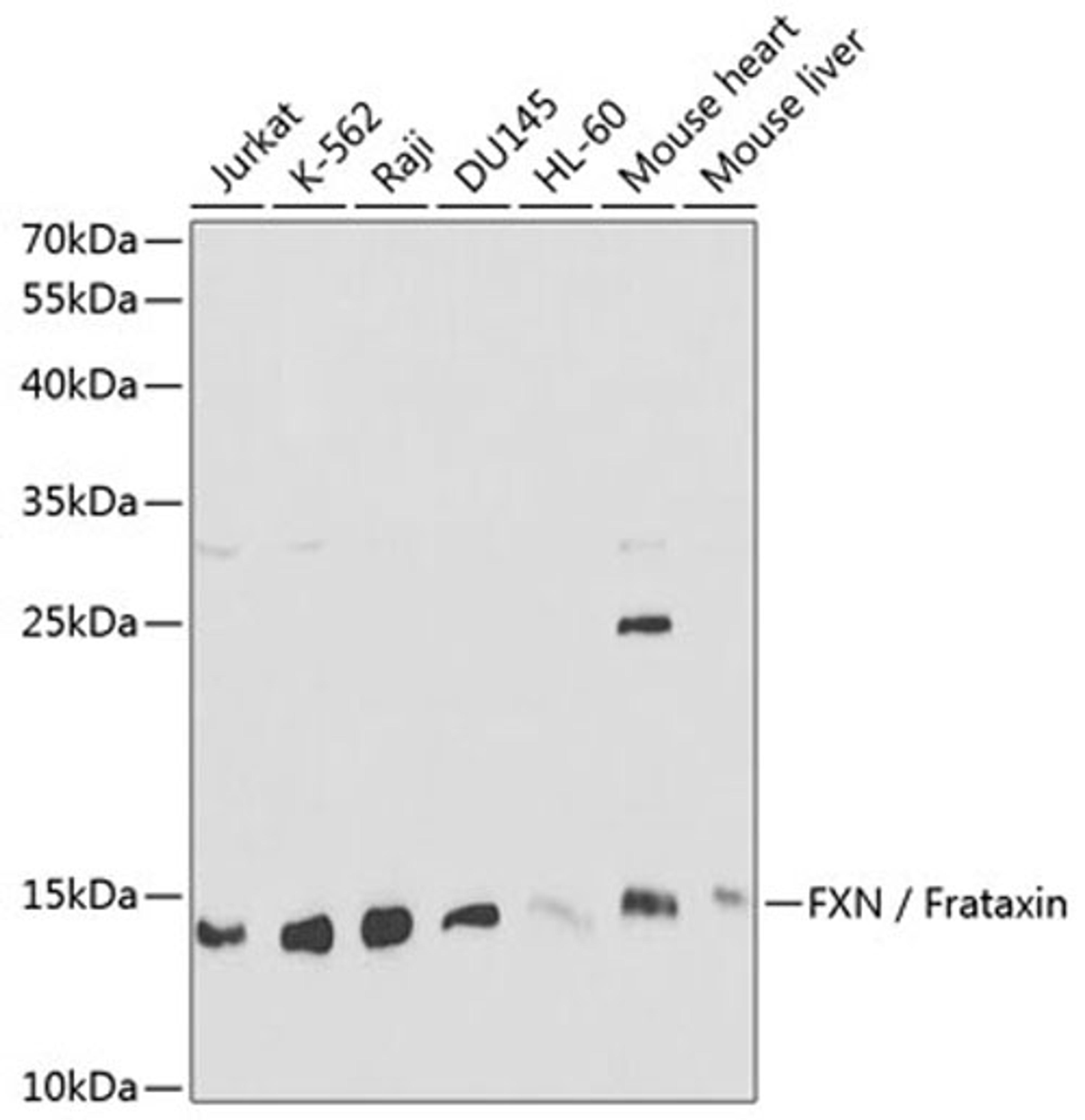 Western blot - FXN / Frataxin antibody (A1745)