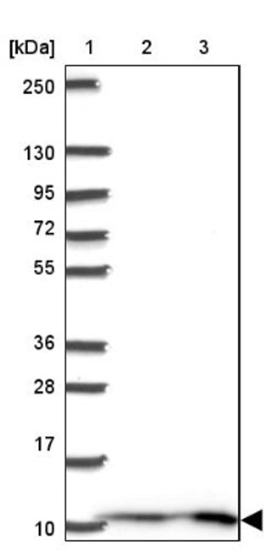 Western Blot: MP68 Antibody [NBP2-34119] - Lane 1: Marker [kDa] 250, 130, 95, 72, 55, 36, 28, 17, 10<br/>Lane 2: Human cell line RT-4<br/>Lane 3: Human cell line U-251MG sp