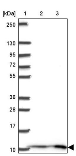 Western Blot: MP68 Antibody [NBP2-34119] - Lane 1: Marker [kDa] 250, 130, 95, 72, 55, 36, 28, 17, 10<br/>Lane 2: Human cell line RT-4<br/>Lane 3: Human cell line U-251MG sp