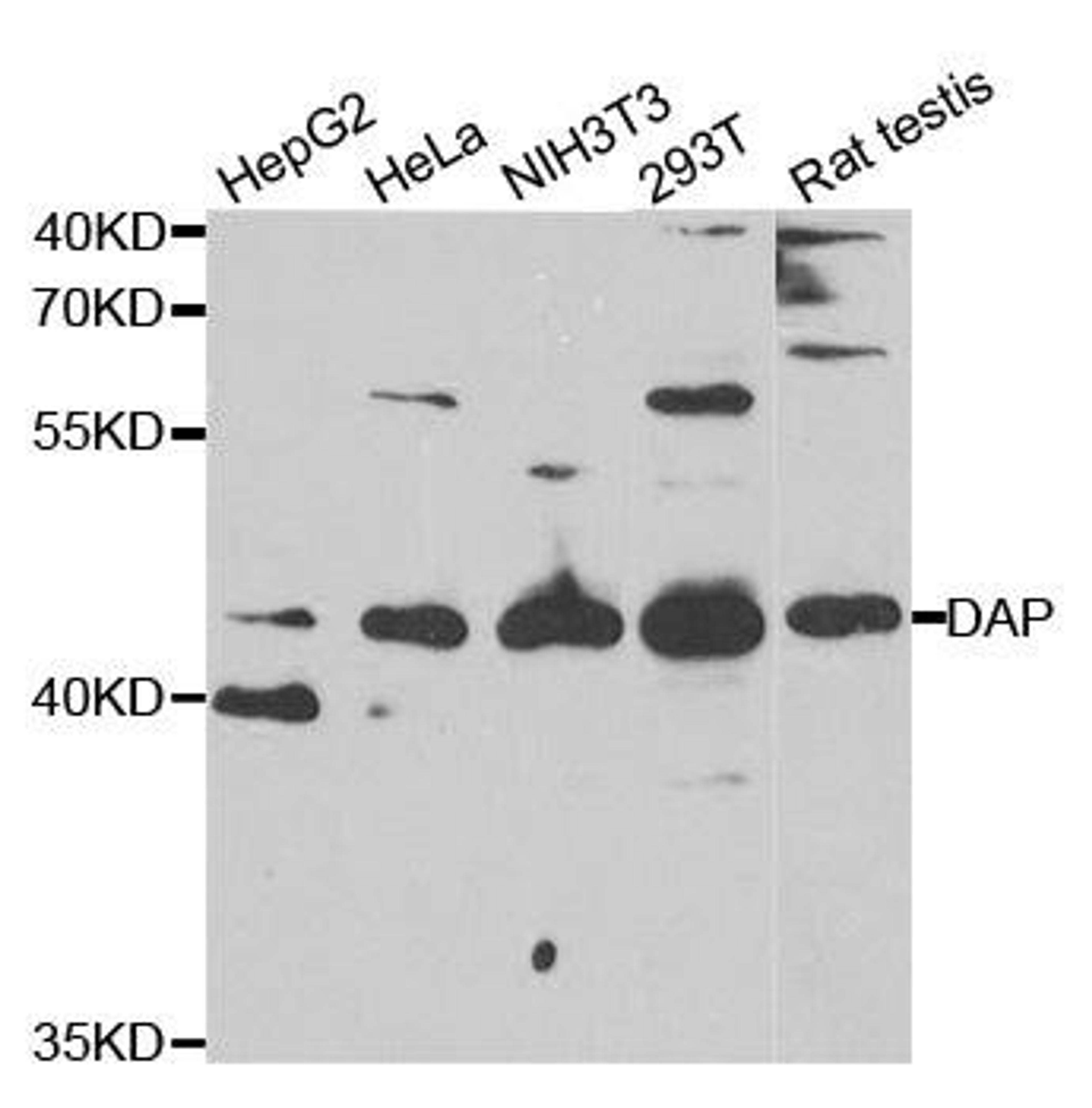 Western blot analysis of extracts of various cell lines using DAP antibody