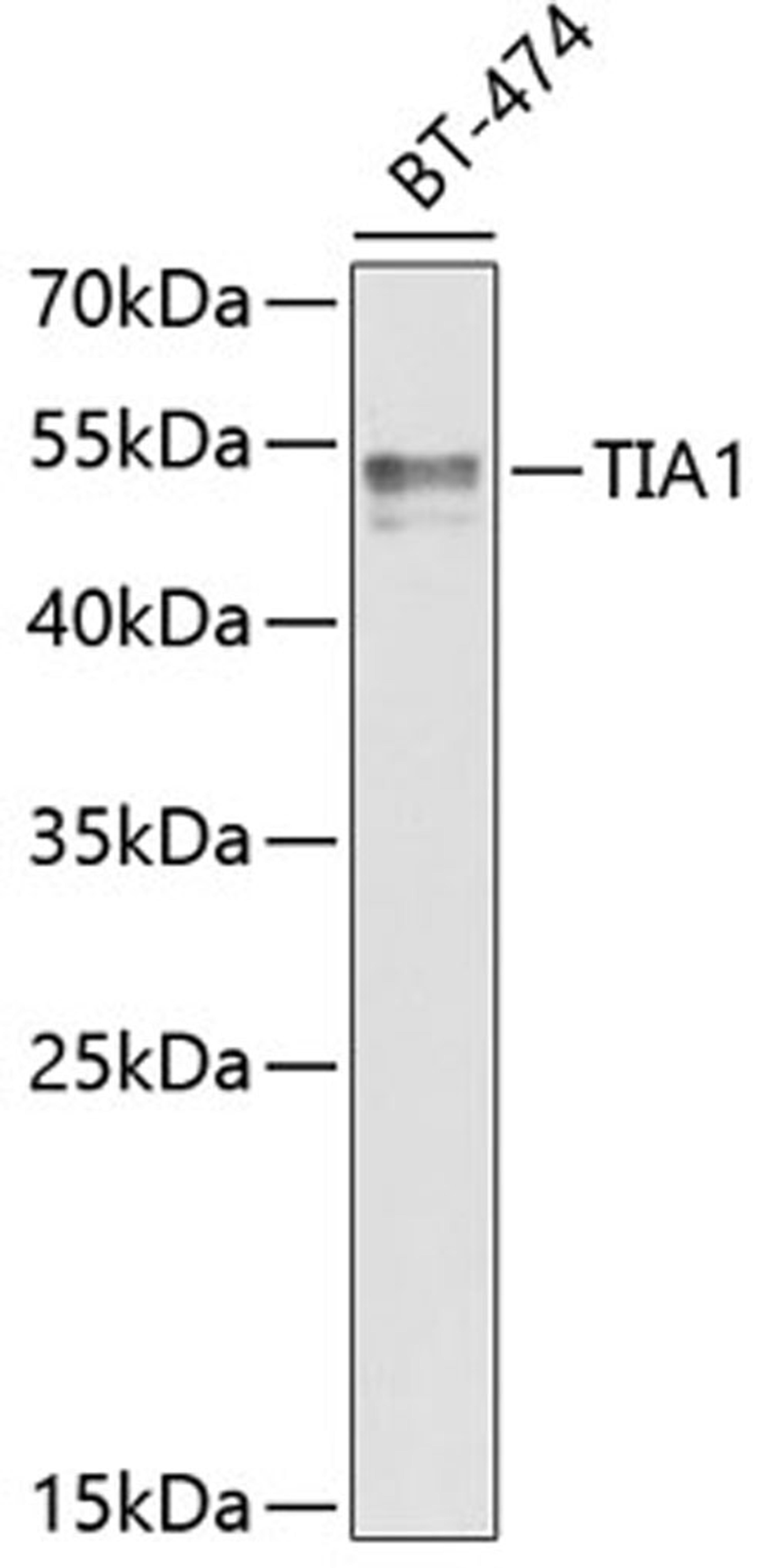 Western blot - TIA1 antibody (A6237)