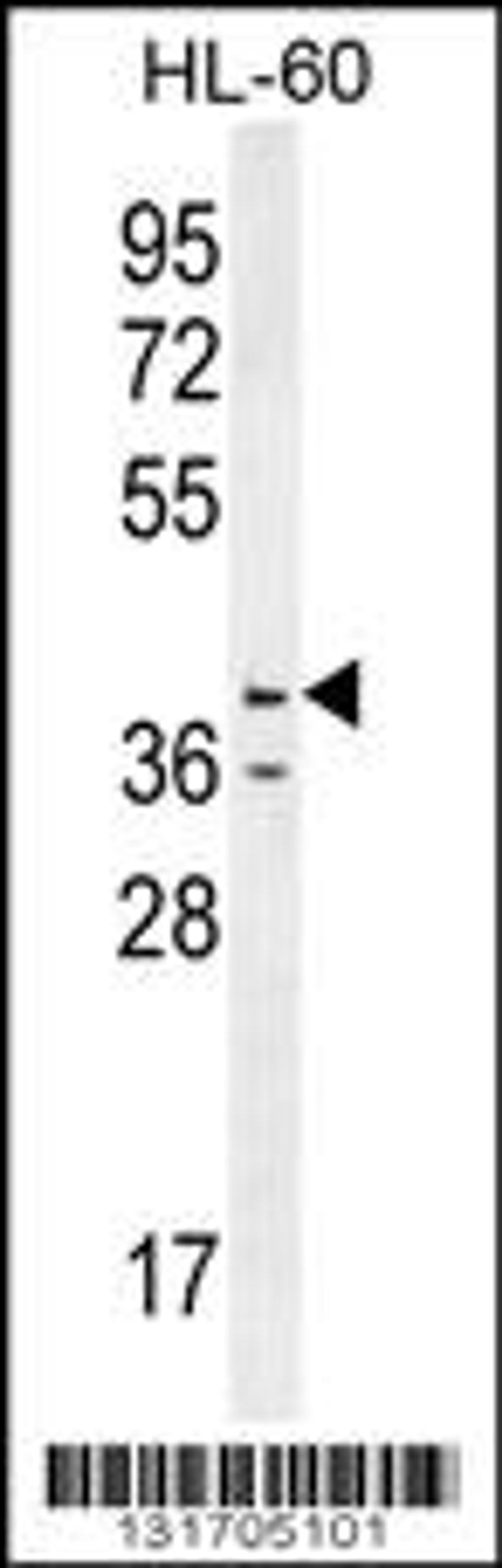 Western blot analysis in HL-60 cell line lysates (35ug/lane).