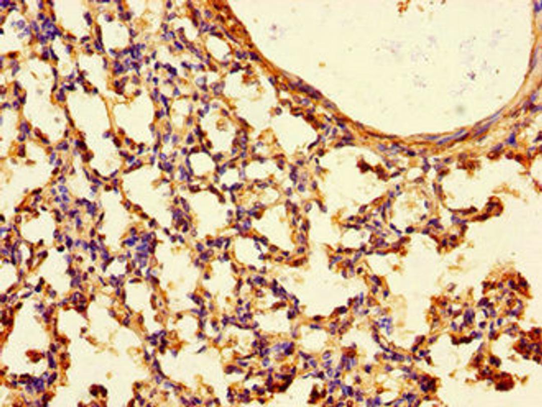 Immunohistochemistry of paraffin-embedded human lung tissue using CSB-PA025265LA01HU at dilution of 1:100