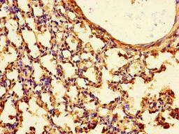 Immunohistochemistry of paraffin-embedded human lung tissue using CSB-PA025265LA01HU at dilution of 1:100