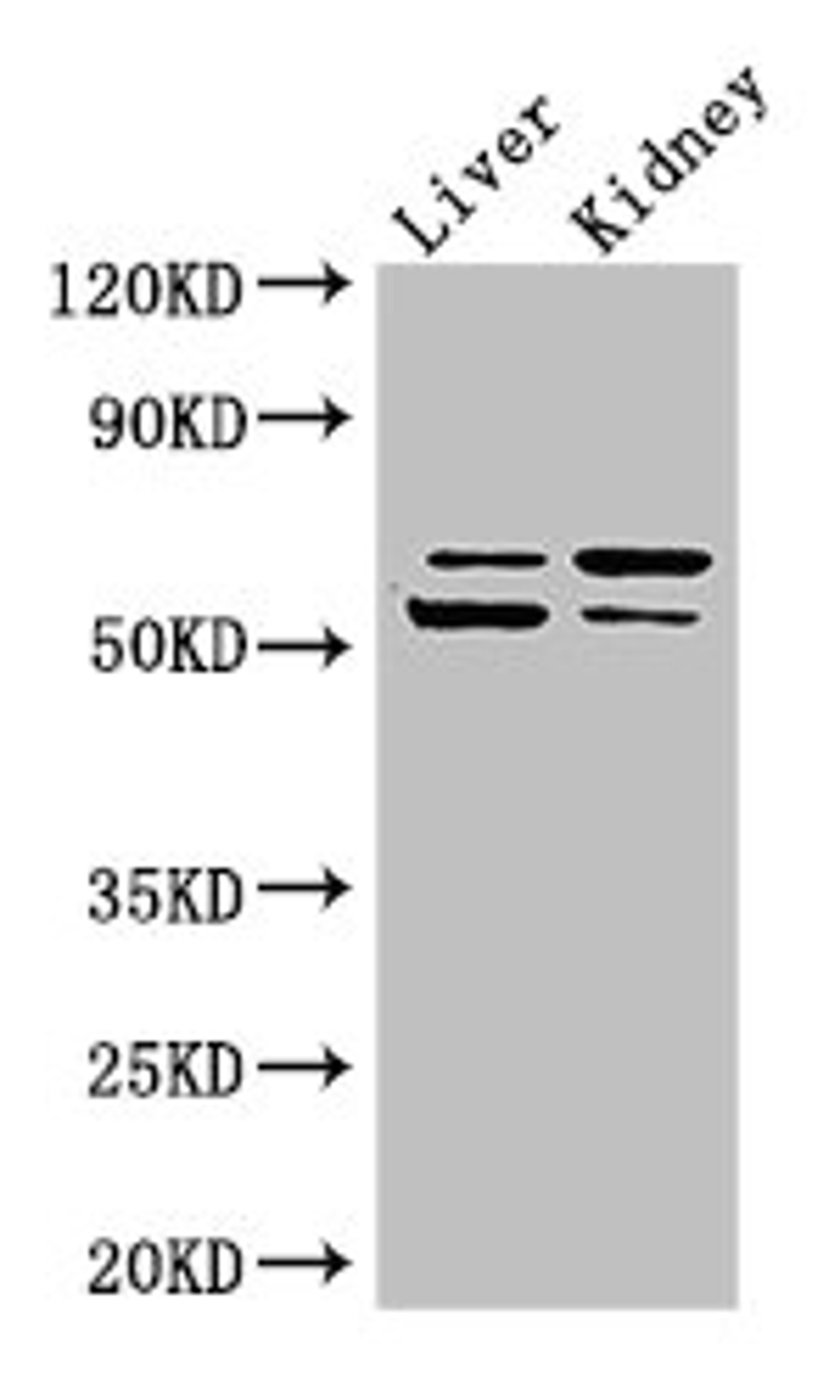 Western Blot. Positive WB detected in: Mouse liver tissue, Mouse kidney tissue. All lanes: LMBRD1 antibody at 4ug/ml. Secondary. Goat polyclonal to rabbit IgG at 1/50000 dilution. Predicted band size: 62, 45, 54, 22 kDa. Observed band size: 62, 54 kDa. 