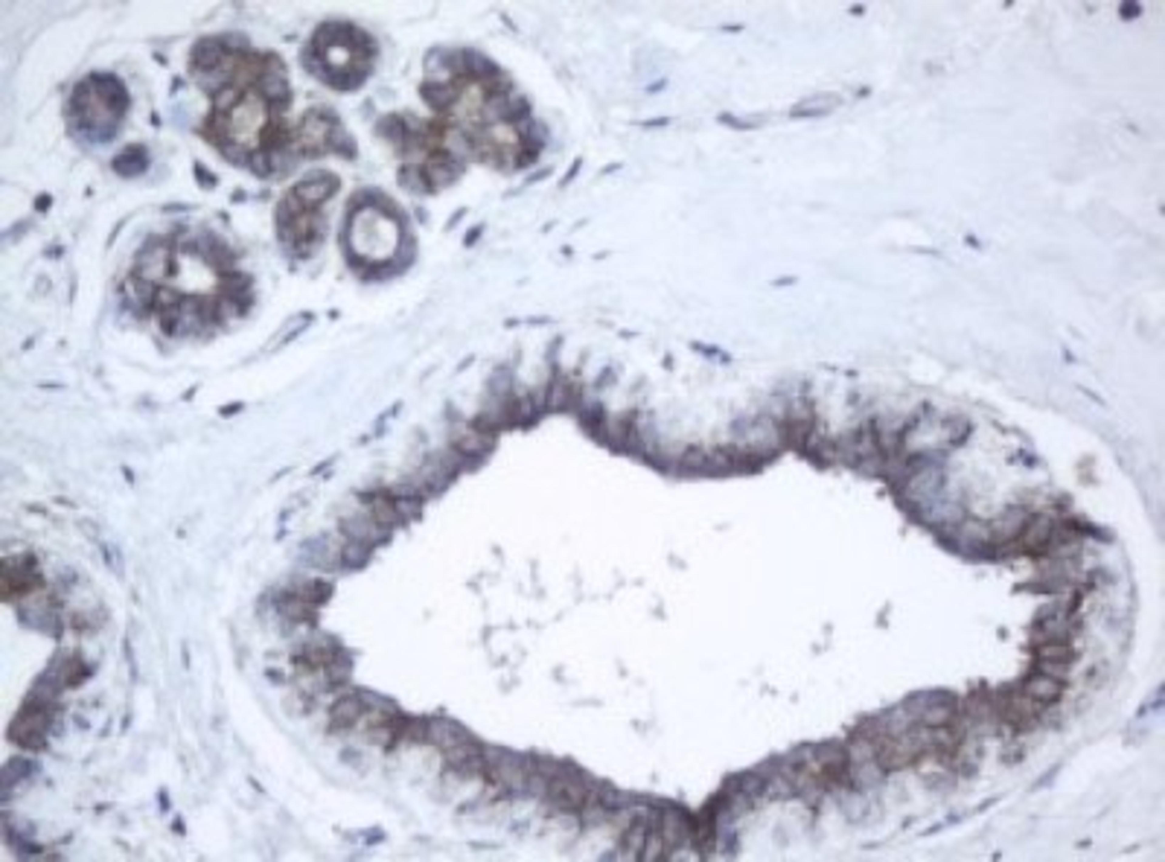 Immunohistochemistry: PPT1 Antibody (1F10) [NBP2-45388] - Analysis of Human breast tissue. (Heat-induced epitope retrieval by 10mM citric buffer, pH6.0, 120C for 3min)