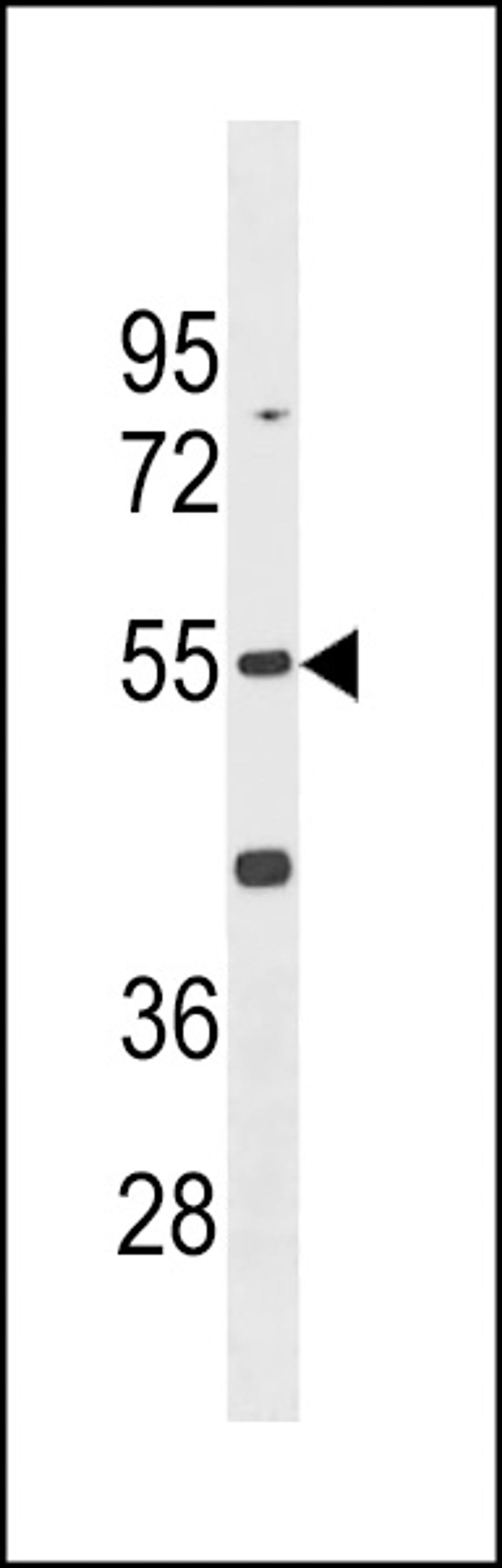 Western blot analysis in K562 cell line lysates (35ug/lane).This demonstrates the Mdetected the Mouse Cdk14 protein (arrow).