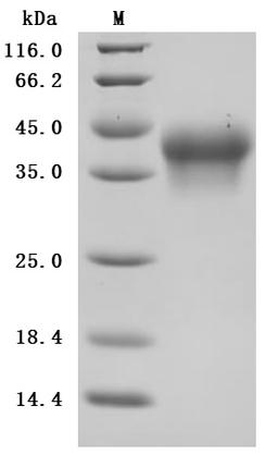 (Tris-Glycine gel) Discontinuous SDS-PAGE (reduced) with 5% enrichment gel and 15% separation gel.