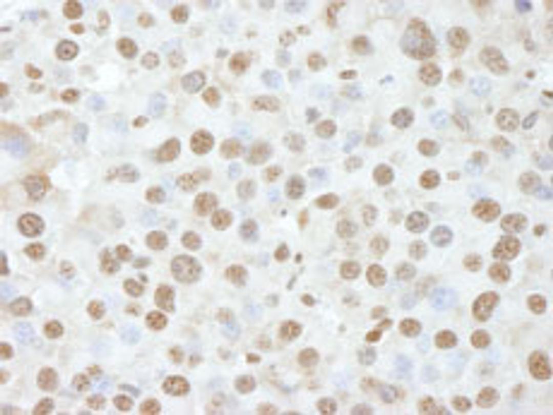 Detection of mouse NUCKS by immunohistochemistry.
