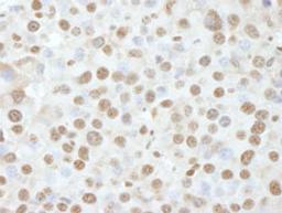 Detection of mouse NUCKS by immunohistochemistry.
