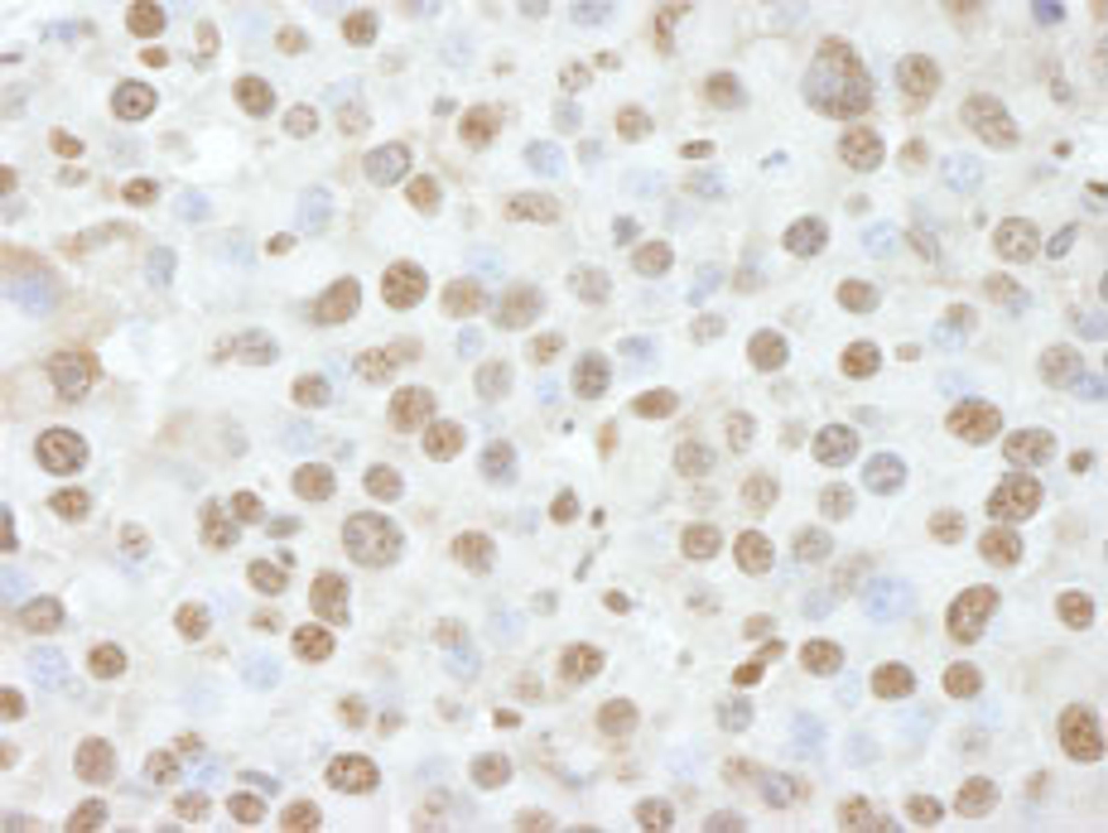 Detection of mouse NUCKS by immunohistochemistry.