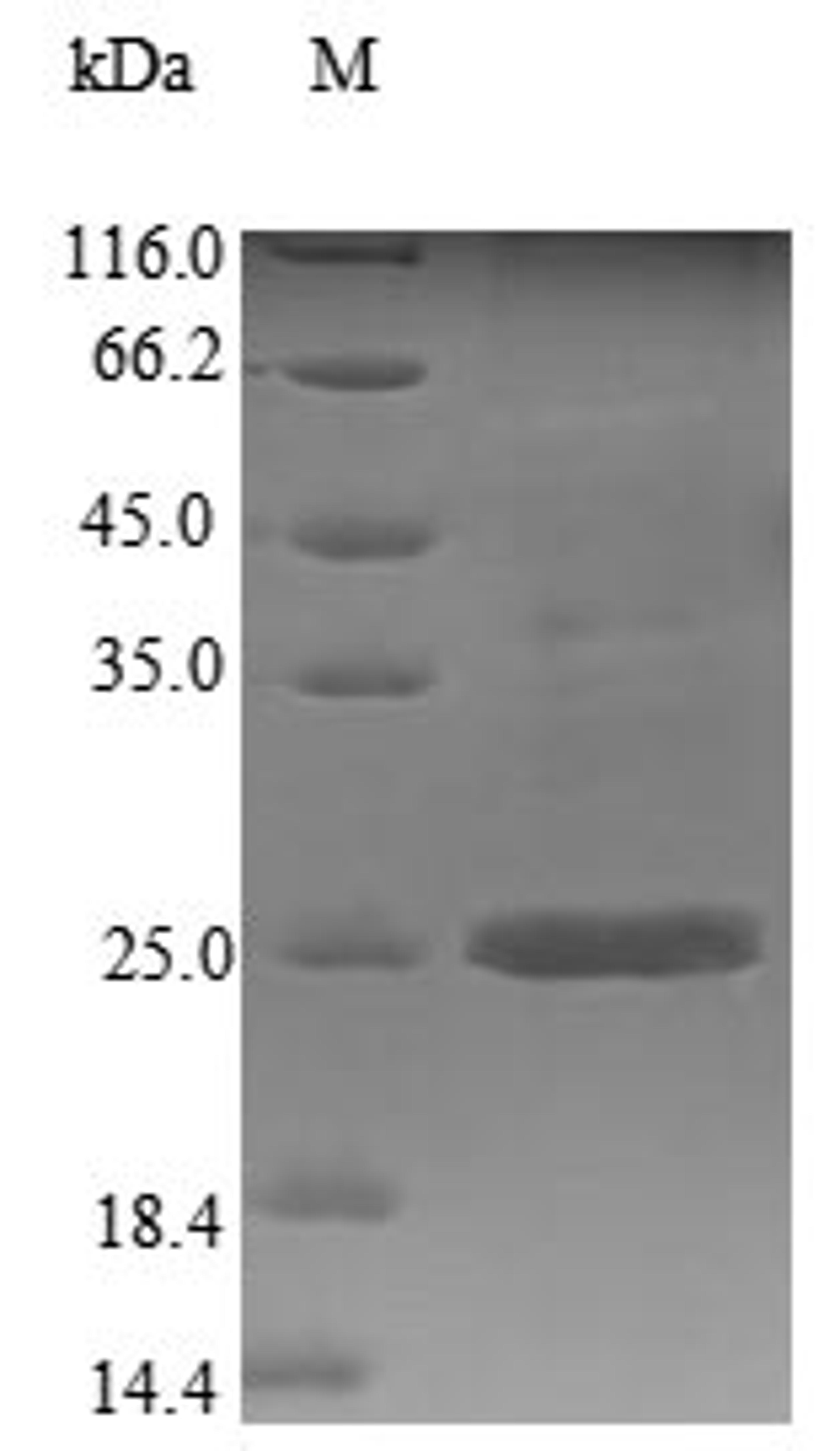 (Tris-Glycine gel) Discontinuous SDS-PAGE (reduced) with 5% enrichment gel and 15% separation gel.