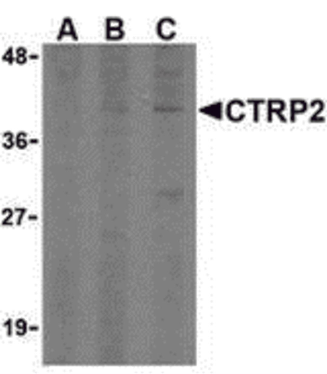 Western blot analysis of CTRP2 in 3T3 (Balb) cell lysate with CTRP2 (IN) antibody at (A) 1, (B) 2, and (C) 4 μg/mL.