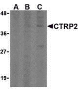 Western blot analysis of CTRP2 in 3T3 (Balb) cell lysate with CTRP2 (IN) antibody at (A) 1, (B) 2, and (C) 4 μg/mL.
