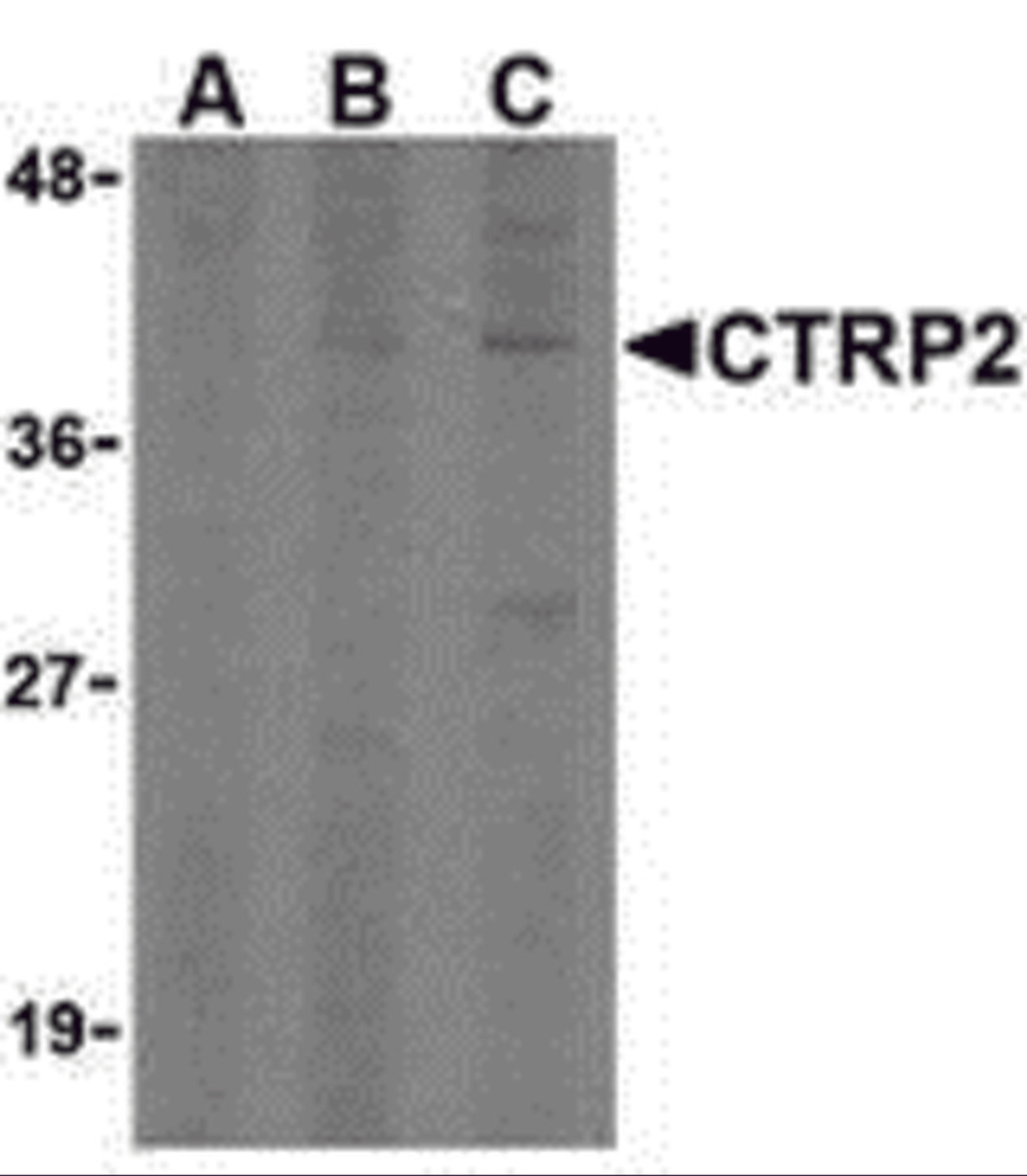 Western blot analysis of CTRP2 in 3T3 (Balb) cell lysate with CTRP2 (IN) antibody at (A) 1, (B) 2, and (C) 4 μg/mL.