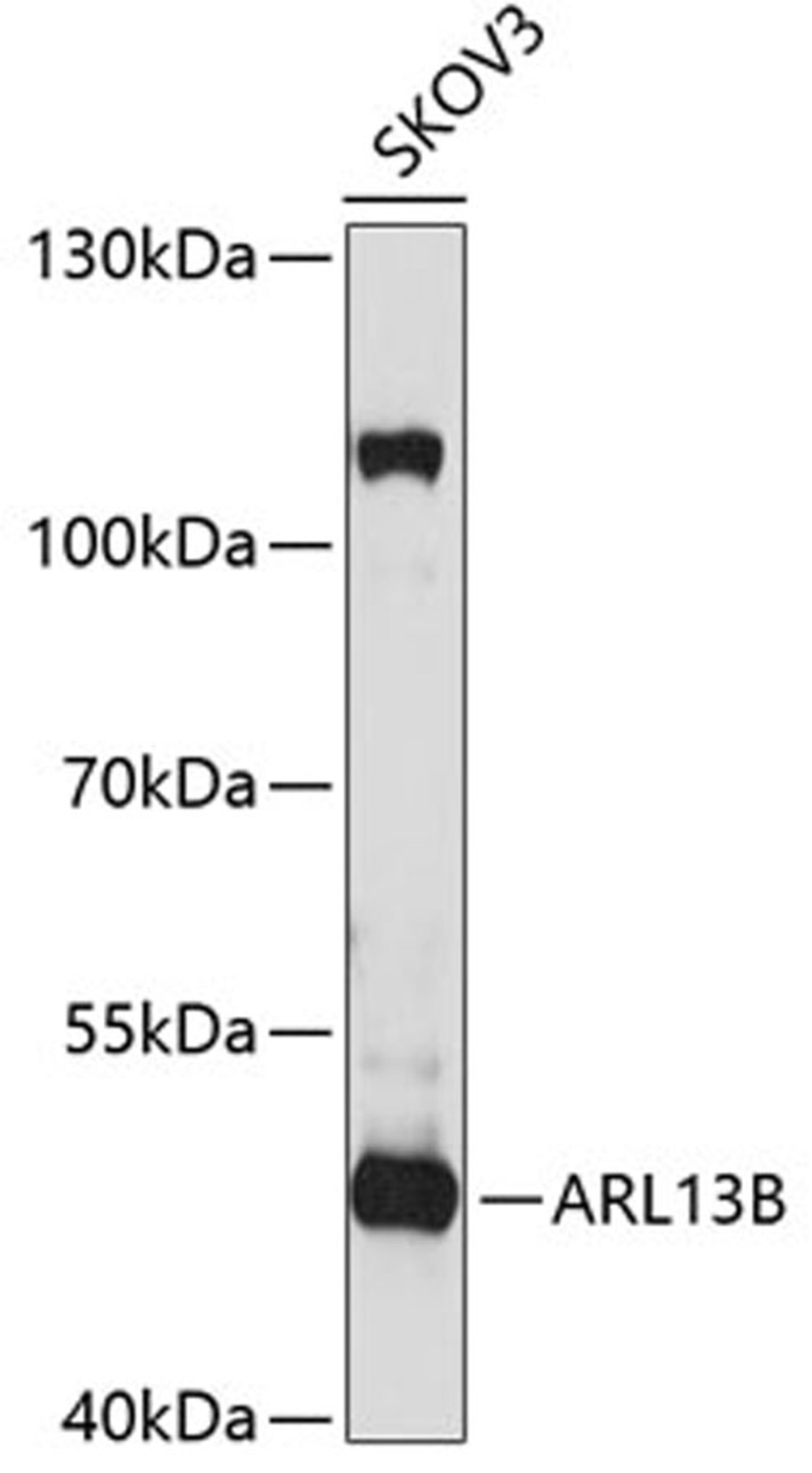 Western blot - ARL13B antibody (A5200)