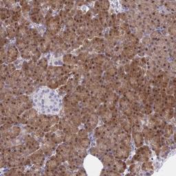 Immunohistochemistry: HOXD12 Antibody [NBP2-32462] - Staining of human pancreas shows moderate cytoplasmic and nuclear positivity in exocrine glandular cells.