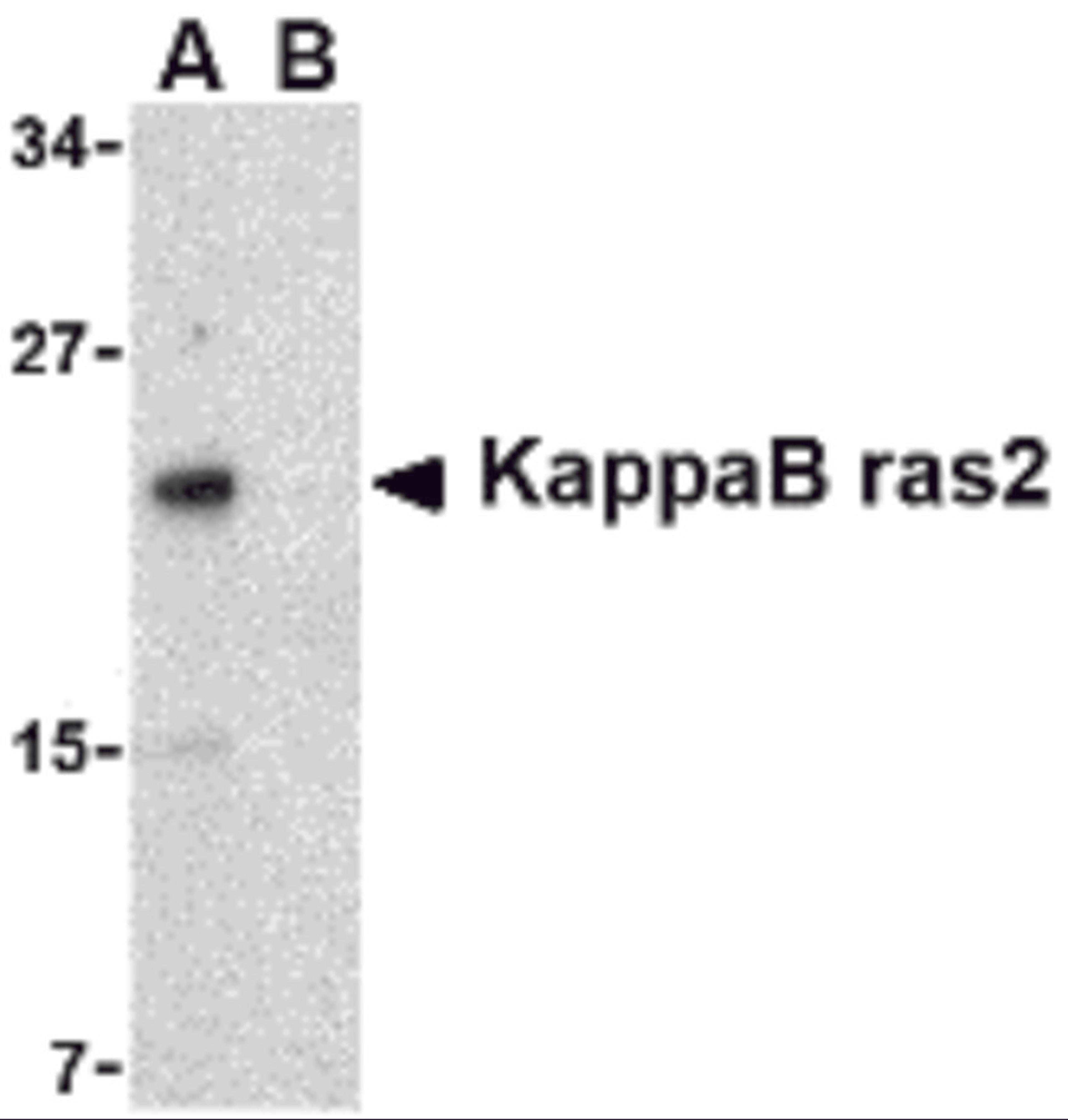 Western blot analysis of KappaB ras2 in RAW264.7 cell lysate with KappaB ras2 antibody at 1 μg/mL in the (A) absence and (B) presence of blocking peptide.