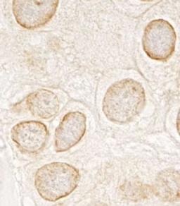 Detection of human LAP1B by immunohistochemistry.