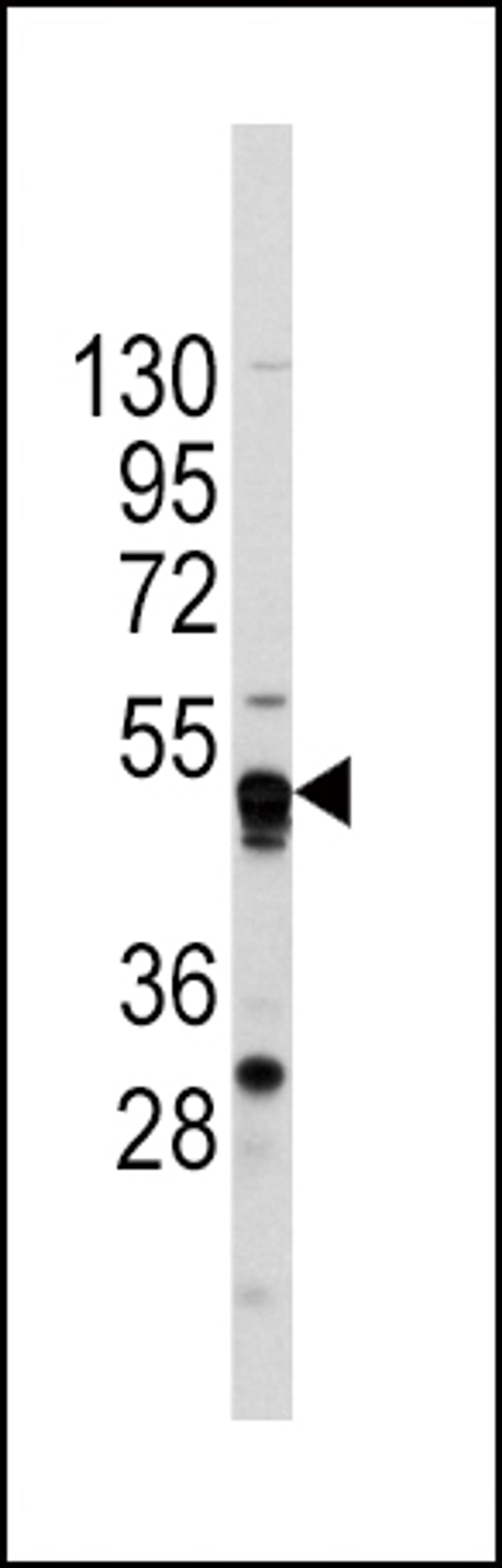 Western blot analysis of anti-GATA4 Antibody in CEM cell line lysates (35ug/lane).