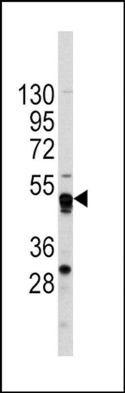 Western blot analysis of anti-GATA4 Antibody in CEM cell line lysates (35ug/lane).